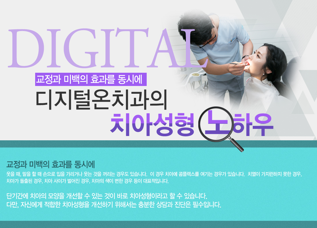 치아성형노하우