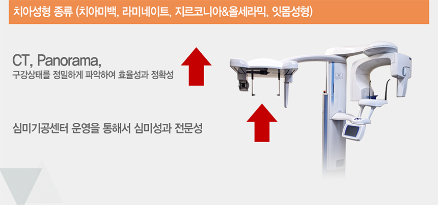 치아성형종류