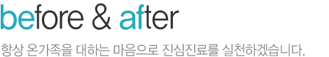 before & after