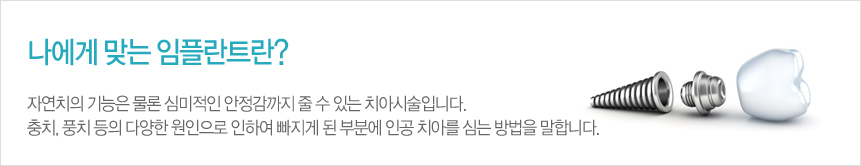 나에게 맞는 임플란트란?