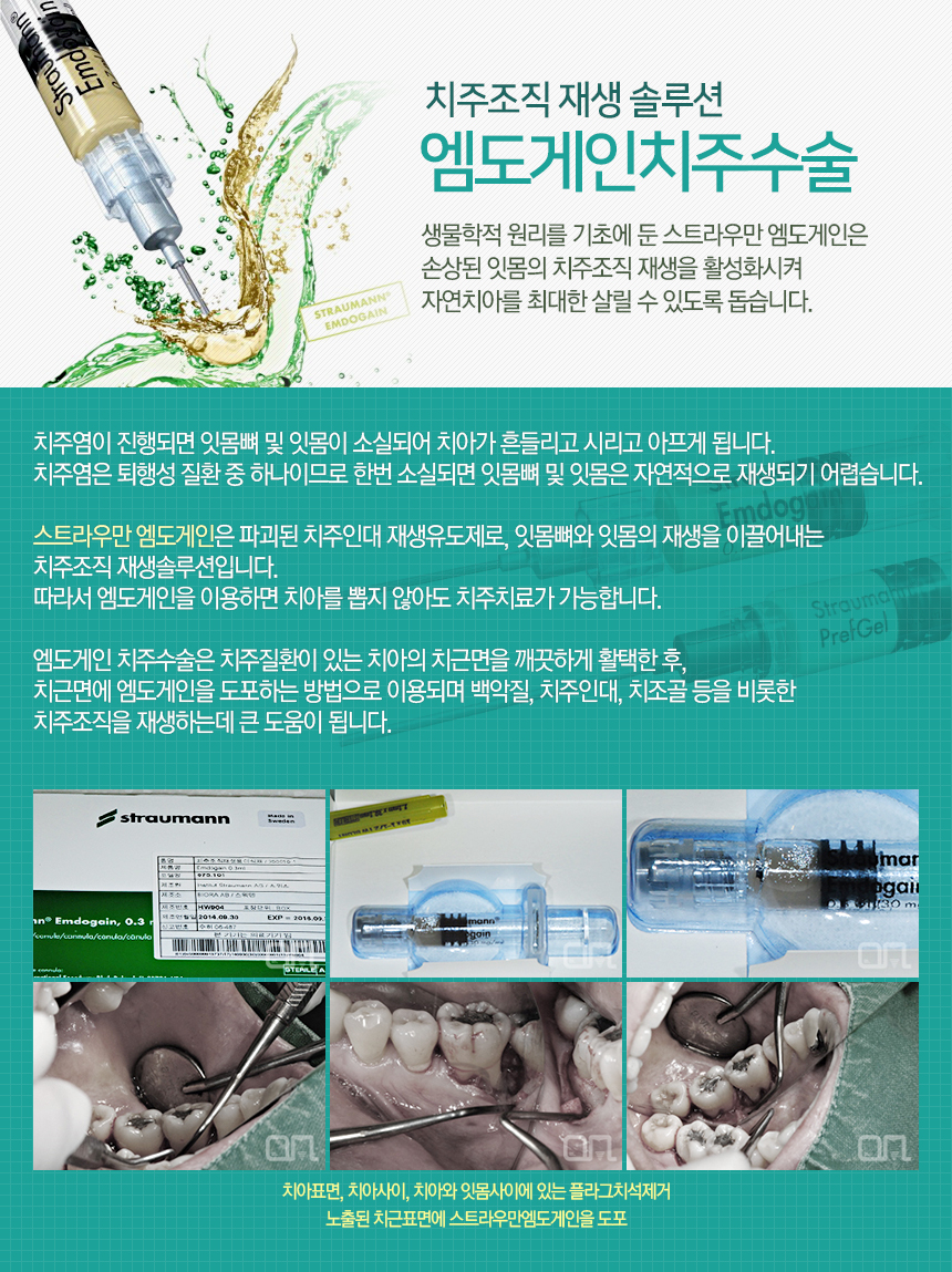 엠도게인