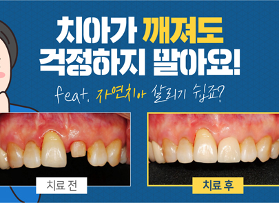 동영상2